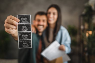 Birkaç el yaklaş. Bebeğin ultrason fotoğrafını tut.