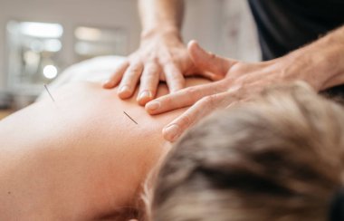 Terapistin elleri ince iğne akupunktur tedavisi sırasında nazikçe sırtına masaj yapıyor. Görüntü, klinikte gevşemeyi, alternatif tıp sağlık uygulamalarını ön plana çıkarıyor. Sağlık ve vücut bakımı kavramı