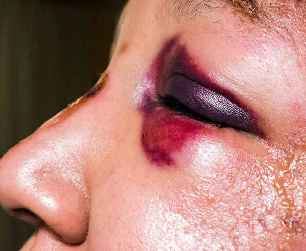 Γυναίκα Μαύρο Μάτι Σάινερ Κλείσε Έννοια Της Ενδοοικογενειακής Βίας — Φωτογραφία Αρχείου