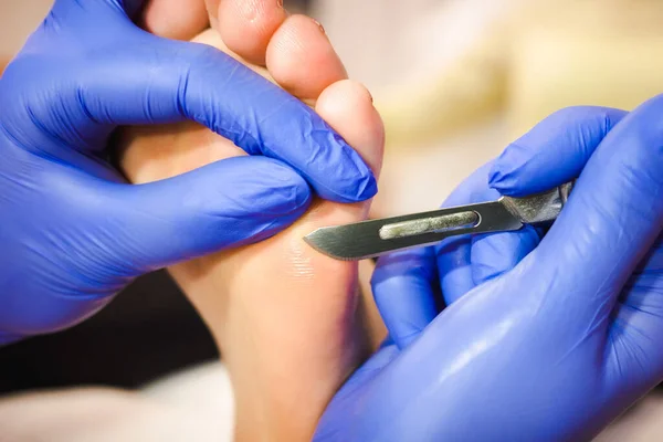 Foot Treatment Spa Salon Medical Pedicure Procedure Using Special Instrument — Stock Photo, Image