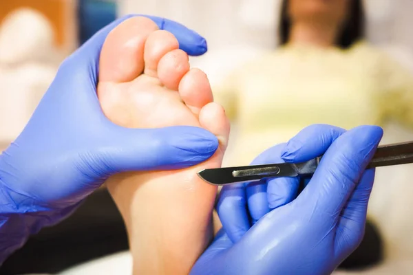 Medicinal Pedicure. The Doctor Removes The Imprint On The Foot With A  Scalpel Stock Photo, Picture and Royalty Free Image. Image 77227900.