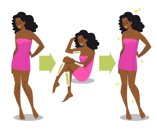 Depilation Stages Woman Hair Removal Flat Style Vector Illustration Isolated — Διανυσματικό Αρχείο
