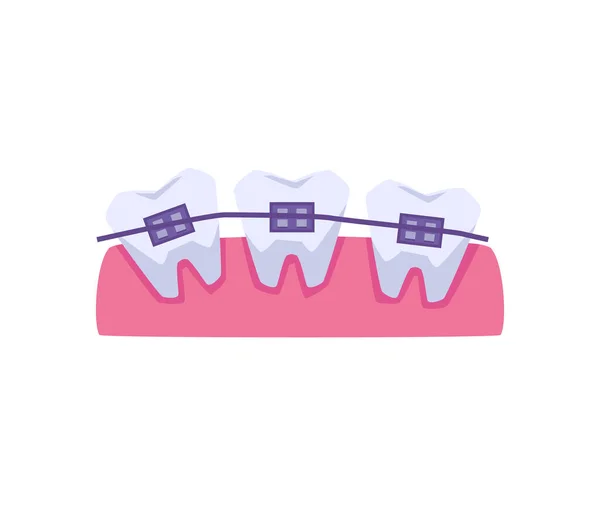 Uneven Row Teeth Braces Flat Style Vector Illustration Isolated White — Archivo Imágenes Vectoriales