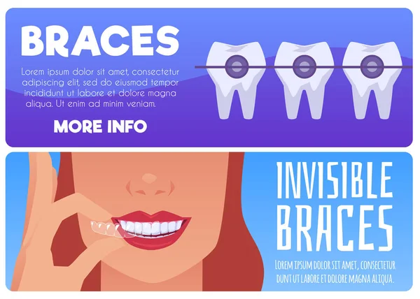 Set Website Banner Templates Braces Flat Style Vector Illustration Isolated — Archivo Imágenes Vectoriales