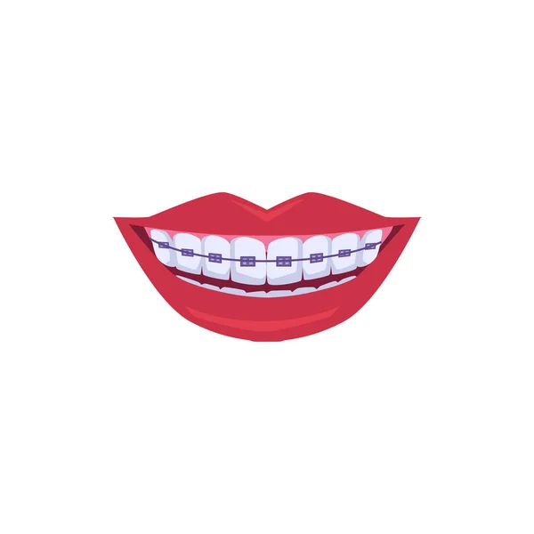 Red Lips Smiling Purple Dental Braces Flat Vector Illustration Isolated — Stock Vector