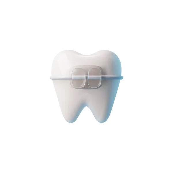 真实健康的牙齿与托架3D风格 矢量图形孤立在白色背景 牙齿对齐 装饰设计元素 正畸及牙科 — 图库矢量图片