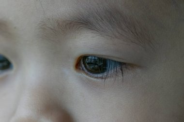 2 yaşındaki delikanlının aşırı yakın çekimi.