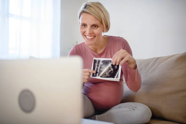 Kobieta Ciąży Pokazuje Zdjęcie Usg Dziecka Kamery Internetowej — Zdjęcie stockowe