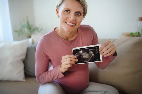 Těhotná Žena Ukazující Ultrazvukové Fotky Dítěte — Stock fotografie