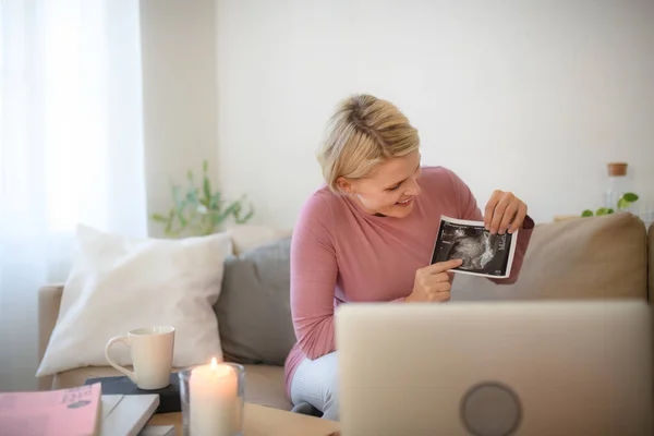 Mujer Embarazada Mostrando Foto Ultrasonido Bebé Webcam — Foto de Stock