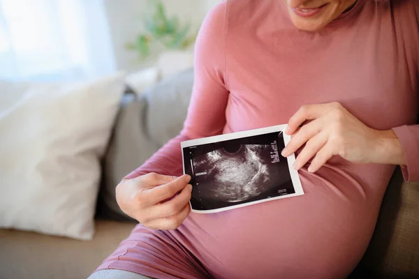 赤ん坊の超音波写真を示す妊婦 — ストック写真