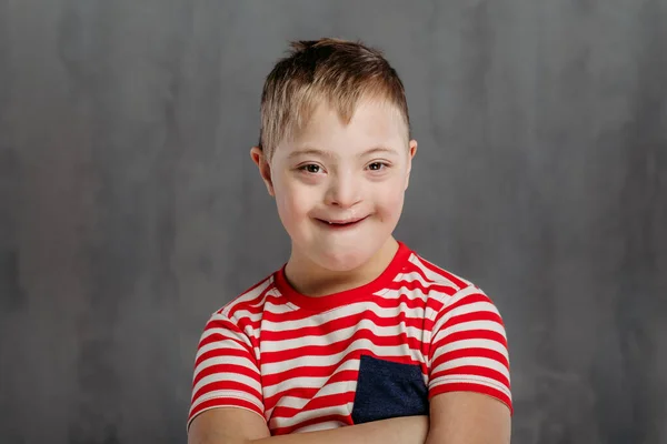 Porträt Eines Kleinen Jungen Mit Syndrom Studioaufnahme — Stockfoto