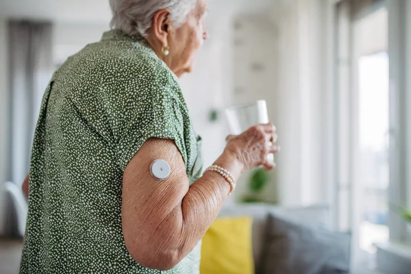 Diabetický Starší Pacient Používající Kontinuální Monitorování Hladiny Glukózy Kontrole Hladiny — Stock fotografie