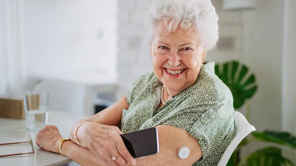 糖尿病老年患者在家里用持续的血糖监测器检查血糖水平 老年妇女将Cgm和智能手机连接起来 实时查看血糖水平 横幅与 — 图库照片