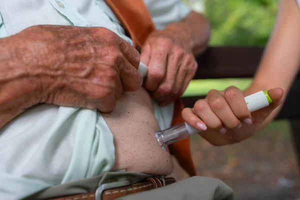 老年糖尿病患者腹部注射胰岛素的护士在城市公园用注射器针隔离老年1型糖尿病患者 教导长者如何注射的护士 — 图库照片
