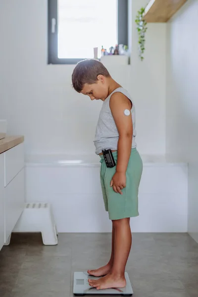 Ein Kleiner Junge Mit Diabetes Wiegt Sich Auf Einer Waage — Stockfoto
