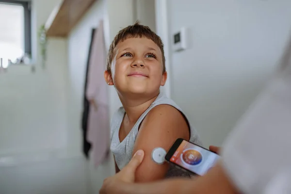 Pojke Med Diabetes Kontrollerar Blodglukosnivån Hemma Med Hjälp Kontinuerlig Glukosmätare — Stockfoto
