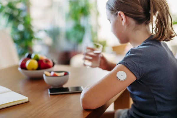Kız Kolundaki Sürekli Glikoz Monitörü Sensörünü Kapat Şeker Hastalığını Iyileştirmek — Stok fotoğraf