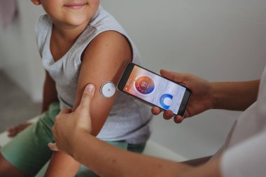 Diyabet hastası çocuk devamlı glikoz monitörü kullanarak kan şekeri seviyesini ölçüyor. Çocuğun annesi kan şekeri seviyesini eş zamanlı izlemek için CGM 'i akıllı telefona bağlıyor..