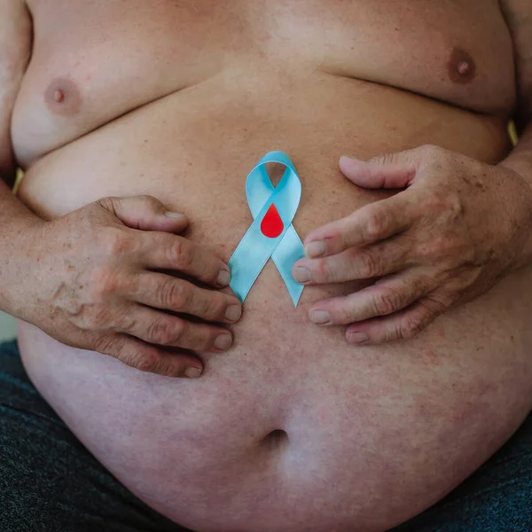 Człowiek Nadwagą Trzymający Niebieską Cukrzycę Wspiera Wstążkę Jako Symbol Świadomości — Zdjęcie stockowe