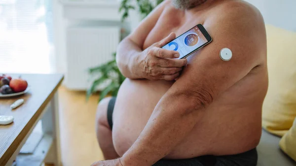 Homme Diabétique Surpoids Connectant Mpc Smartphone Pour Surveiller Son Taux — Photo