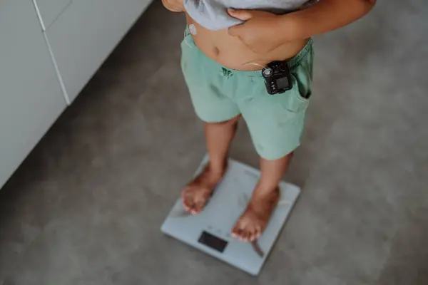 A young boy with diabetes weighing himself on bathroom scale. The need for weight control in pediatric diabetic patients. Boy using continuous glucose monitor.