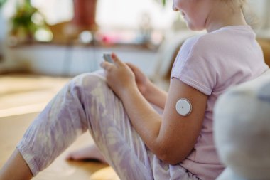 Kolunda sürekli glikoz monitörü olan şeker hastası bir kız. CGM cihazı okul kızının hayatını kolaylaştırıyor, hastalığıyla başa çıkmasına yardımcı oluyor ve diğer aktivitelere odaklanıyor..