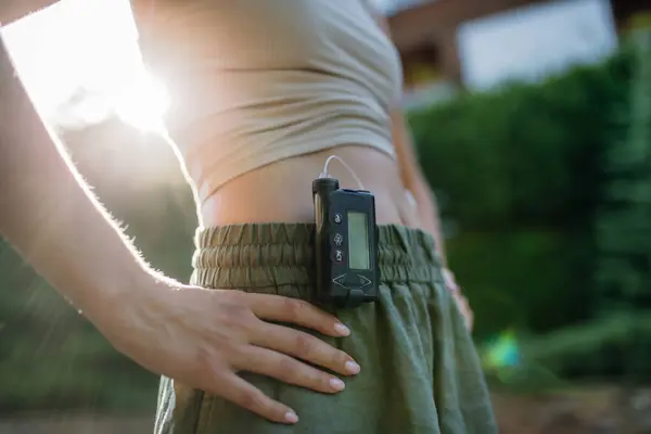 Close up of diabetic woman with insulin pump. Young woman with type 1 diabetes outdoors.