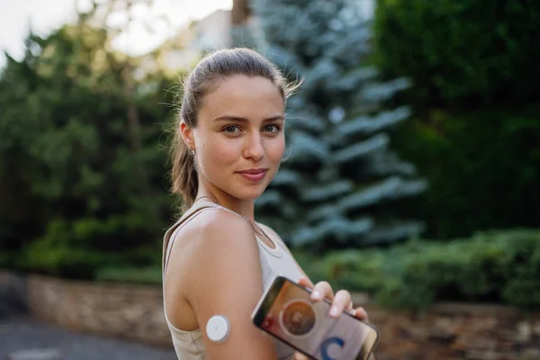 Portrait of woman with diabetes connecting her smartphone to continuous glucose monitor sensor before exercising. Diabetic woman checking her blood sugar levels in real time before running.