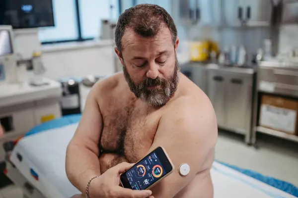 病人用智能手机连接连续血糖监测器 实时检查血糖水平 超重的男人有患上2型糖尿病的危险 健康风险的概念 — 图库照片