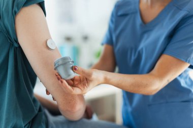 Diyabetolog doktor, hemşire şeker hastası bir gencin koluna sürekli glikoz monitörü takıyor. CGM cihazı, genç çocuğun hayatını kolaylaştırıyor, hastalığıyla başa çıkmasına yardımcı oluyor ve diğer çocuklara odaklanıyor.