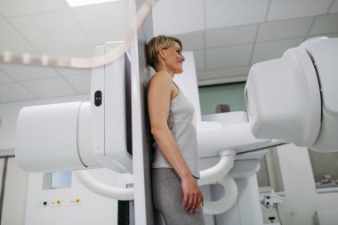 Dinamik X-ray taramasından geçen kadın hasta eğimli floroskopi duvarı ünitesi, duvar destekli radyografik tablo kullanıyor..