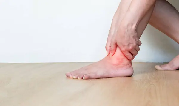 stock image Inflammation of the ankle bones a human