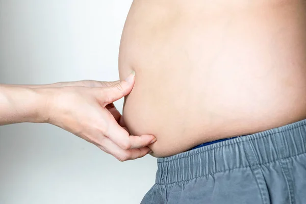 Obézní Děti Nadváha Obezita Břišní Tuk — Stock fotografie