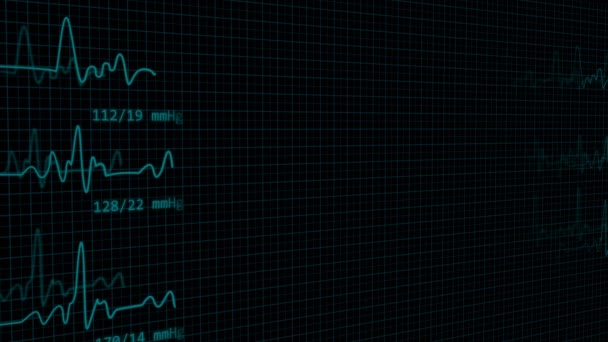 Línea Pulso Latido Cardíaco Ekg Animada Que Muestra Monitor Del — Vídeo de stock
