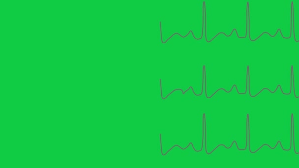 Cardiogramas Animación Ritmo Cardíaco — Vídeo de stock
