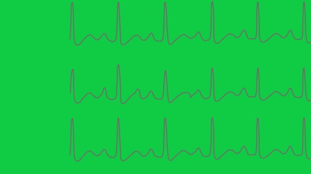 Cardiogrammen Hartslagfrequentie Animatie Groen Scherm — Stockvideo