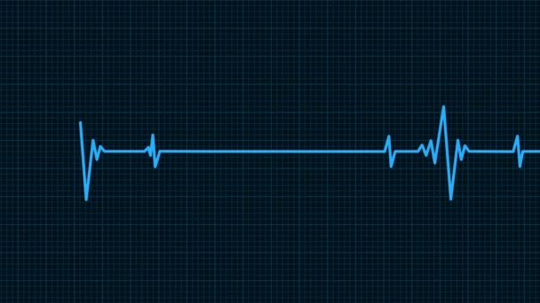 Heartbeat Monitor Linea Frequenza Mentre Morto Rivivere — Video Stock