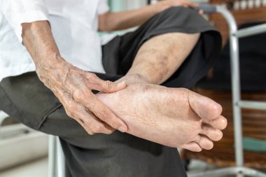 Elderly woman massage her foot,Plantar fasciitis,pain in soles of foot and heel bone,Tarsal tunnel syndrome,compression of a nerve in foot or Achilles tendonitis,inflammation of tendon at back of heel clipart