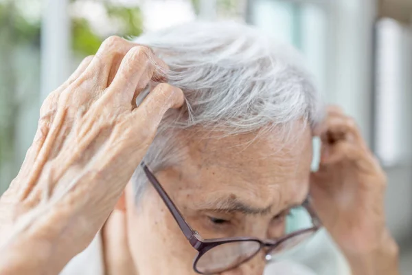 Azjatycka Starsza Kobieta Odczuwająca Swędzenie Skóry Głowy Objawy Zakażeń Grzybiczych — Zdjęcie stockowe