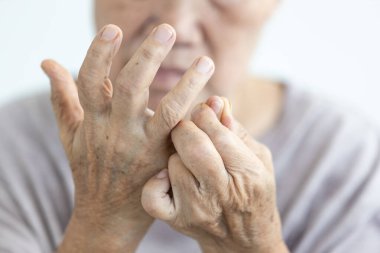 Close up of hands,senior woman suffering Rheumatoid Arthritis,Osteoarthritis,Gout,Rheumatism,old elderly has pain in her fingers,painful inflammation and stiffness of joint and muscles,chronic disease clipart