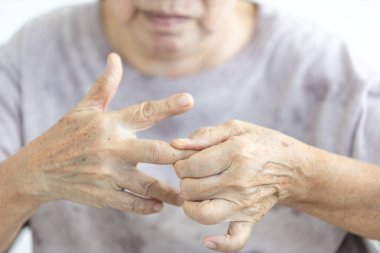 Tetik parmak hastalığı olan yaşlı kadın, elinde ağrı, yaşlı masaj, kas ve eklemleri ovma ve yoğurma, parmaklardaki tendonları esnetme, elini çalıştırma, terapi, sağlık, tıbbi konsept.