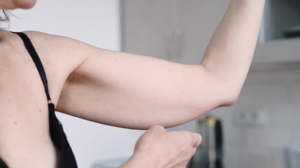 薄毛の腕の皮膚を持つ熟女 手の脂肪の問題 高品質4K映像 — ストック動画