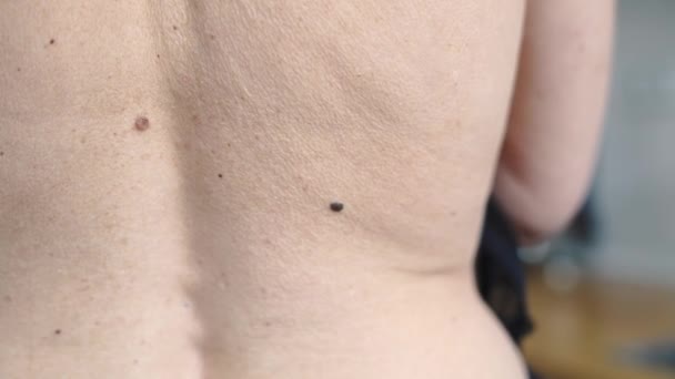 一个成熟的女人在皮肤背面的痣 高质量的4K镜头 — 图库视频影像