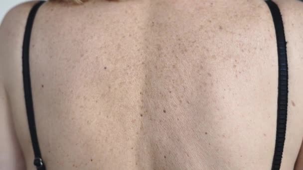 Dojrzała Kobieta Pleców Skóry Plamkami Wieku Dermatologiczny Problem Kosmetyczny Wysokiej — Wideo stockowe