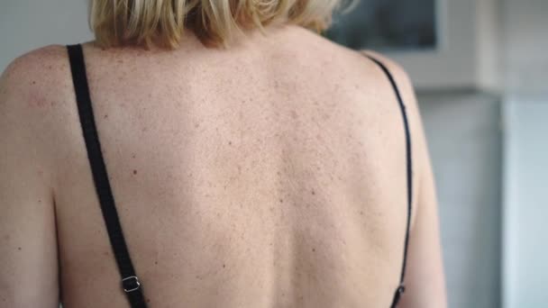 成熟的女人后背皮肤有年龄斑点 皮肤科化妆品问题 高质量的4K镜头 — 图库视频影像