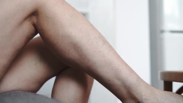 Mulheres Maduras Pernas Close Com Veias Varicosas Problema Imagens Alta — Vídeo de Stock