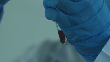 Beyaz önlüklü ve koruyucu eldivenli bir laboratuvar teknisyeni kimyasal bir kaba sıvı döker. Laboratuvar, ağır çekim..