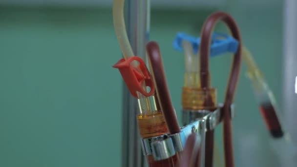 充血的软管和管子从病人的血管中流出 流入透析机 — 图库视频影像