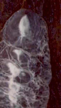 Soyut derin boya, parıltı yayıyor. Alkol mürekkebiyle soyut sanat arkaplan tasarımı. Petri kabındaki boyanın kimyasal reaksiyonunun makro videosu. Mavi Işıltılı Altın Parçacıklar.